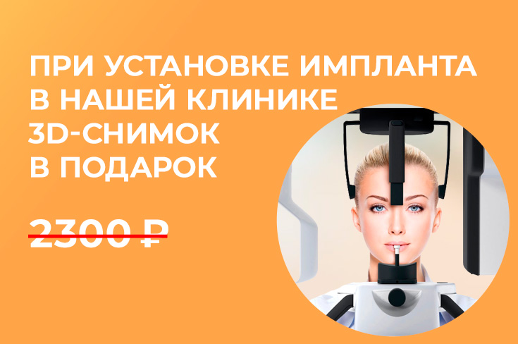 3D-снимок в ПОДАРОК